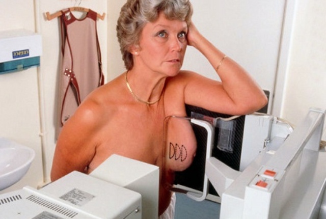 zachem-naznach…t-mammografiyu