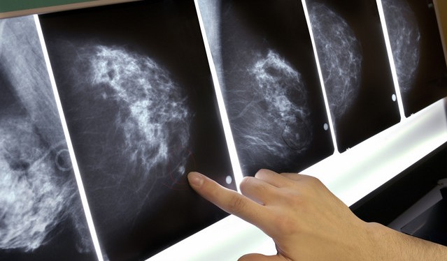 osobennosti-mammografii