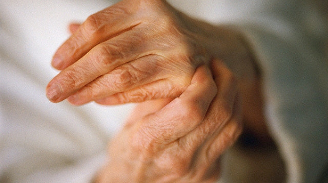 artrit-i-narodnoe-lechenie